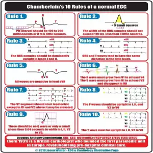 Chamberlain's 10 rules of a normal ECG